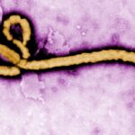 Virus Ebola (Foto CDC Afrika)