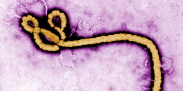Virus Ebola (Foto CDC Afrika)