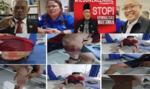Jurnalis Mandi Darah: 15 Organisasi Pers Nasional 'Kepung' Kasus Penusukan Faisal, Presiden dan Kapolri di Minta Usut Tuntas WhatsApp Image at